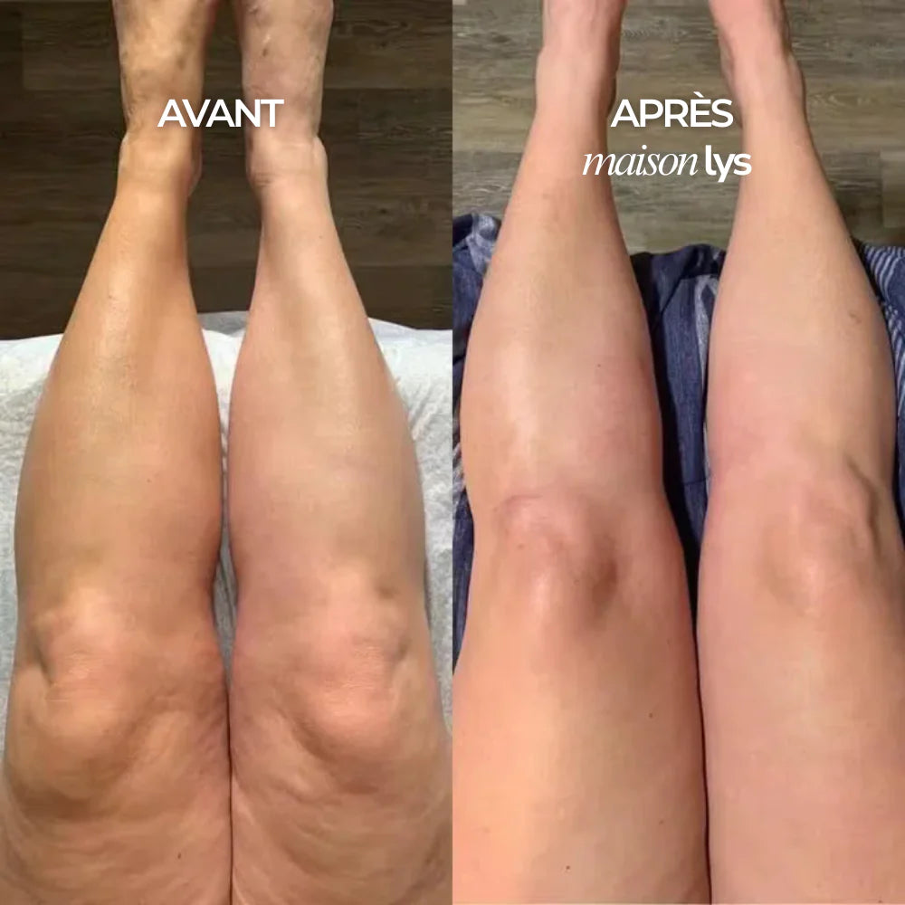 Gouttes Lymphatiques