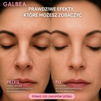 Galbea Bio-Collagen PDRN Plumping Stick