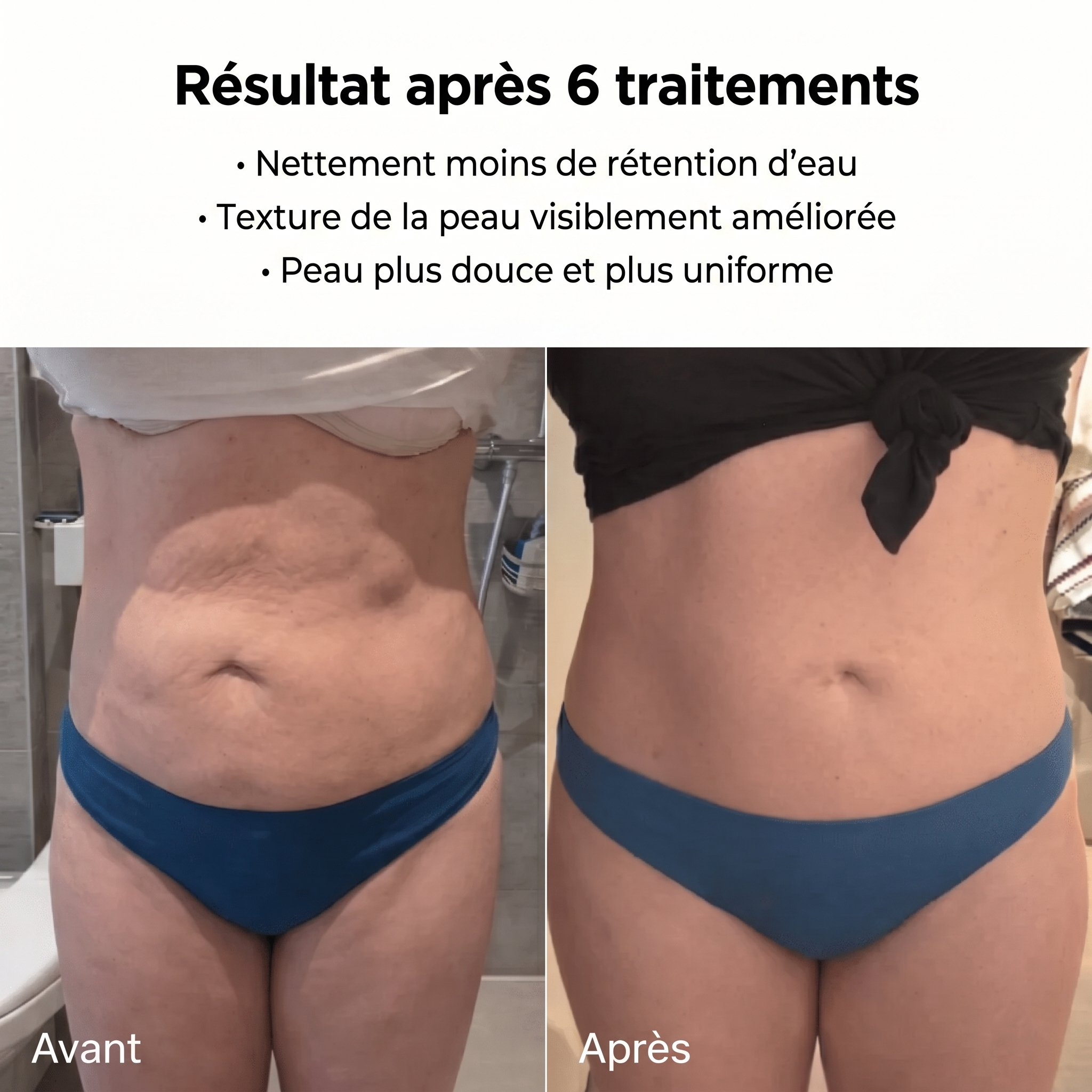Celluviaa - glatte Haut in 14 Tagen