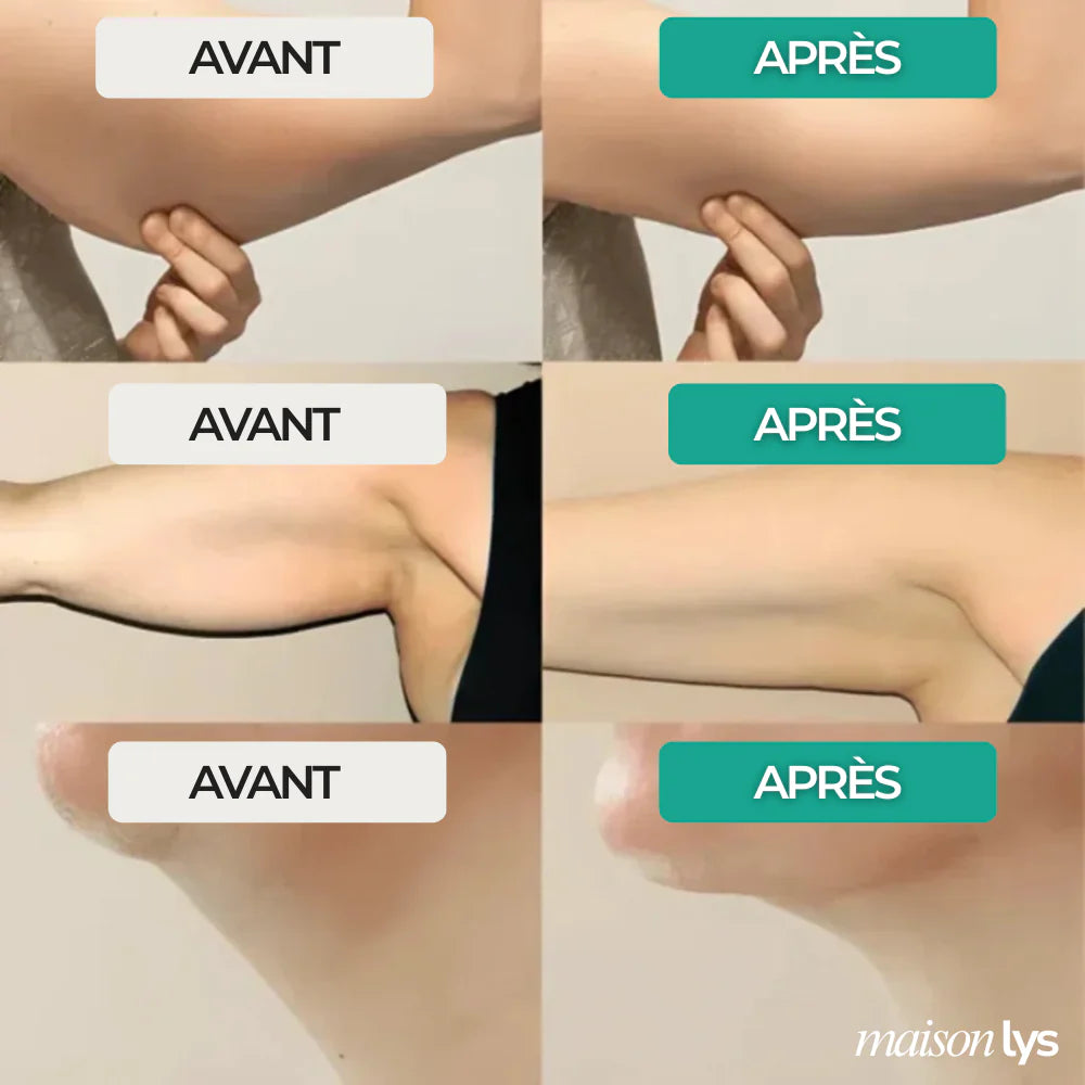 Gouttes Lymphatiques
